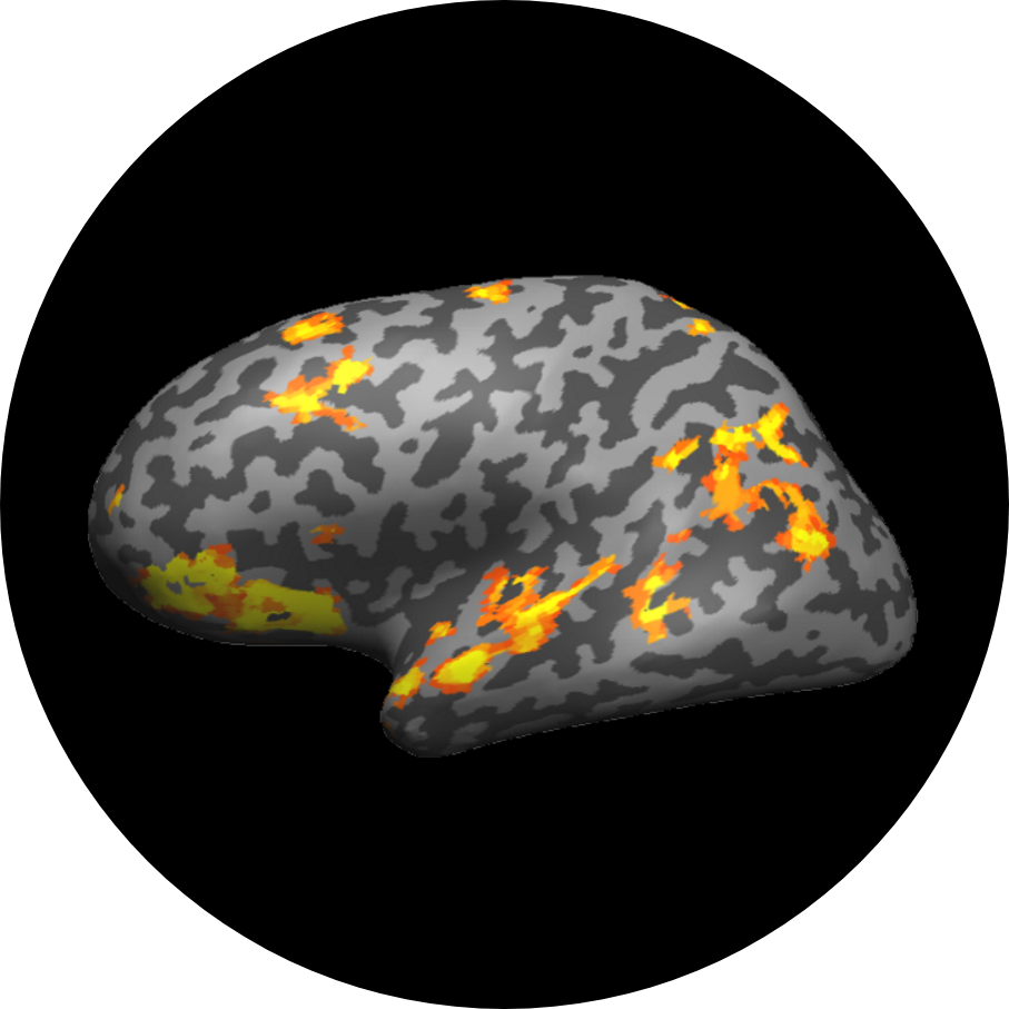 fMRI